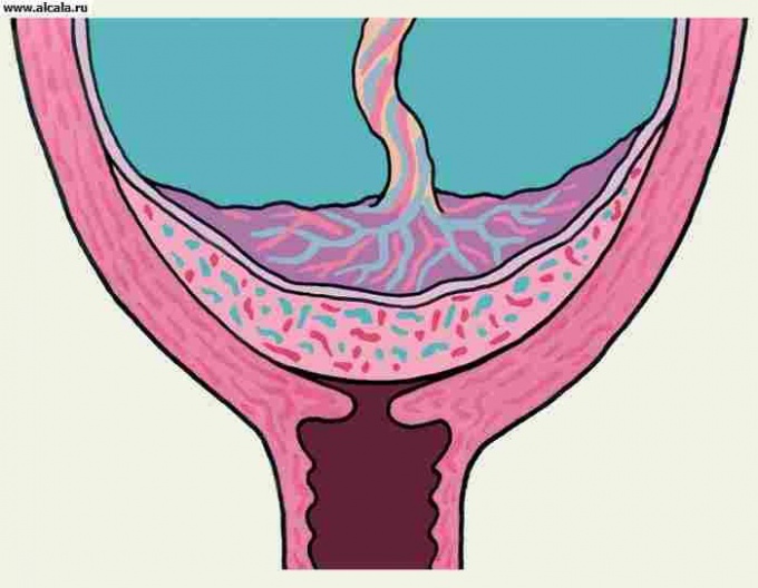 Placenta bemutatás: diagnózis, kezelés, következmények